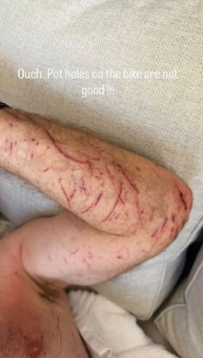 Алан Ширер попал в серьезную аварию на велосипеде